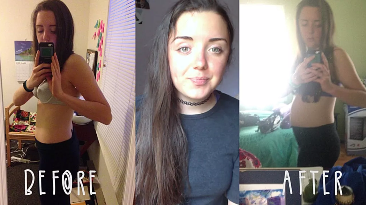 A little bit of pudge on a skinny girl posted by wgwgwg