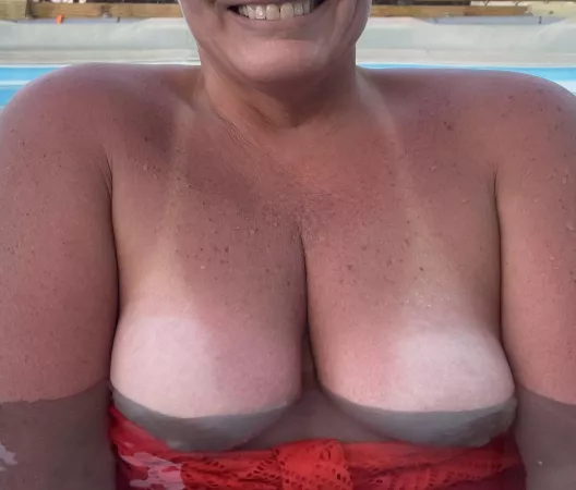 A little too much sun?? by Flsunkat