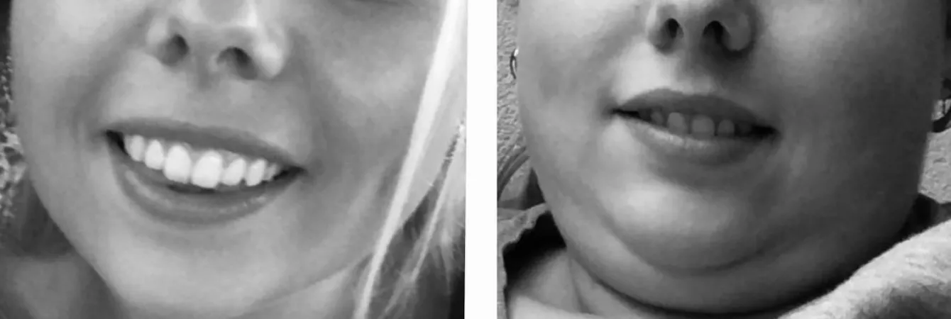 A or B? 🐷 by Intrepid_Escape_108