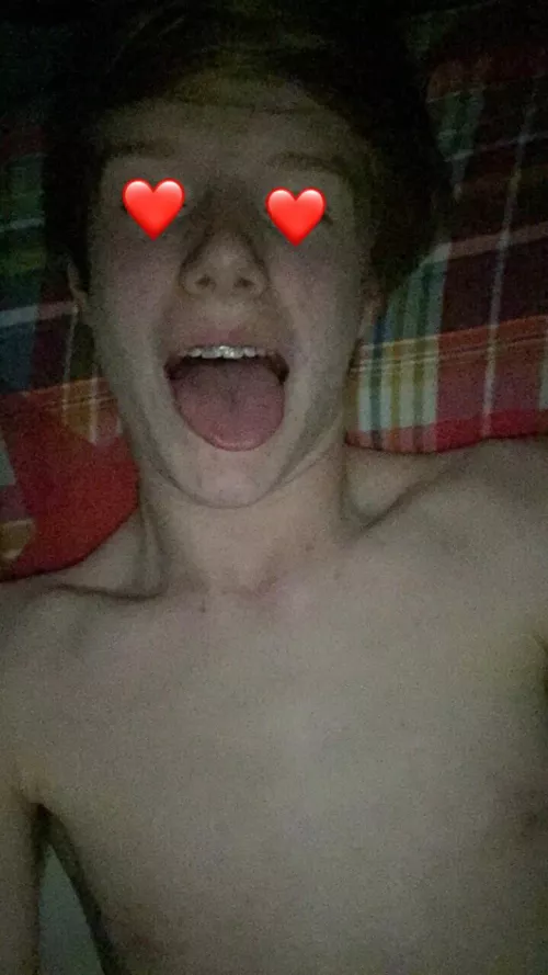 A pic of when I had braces by According-Surprise11