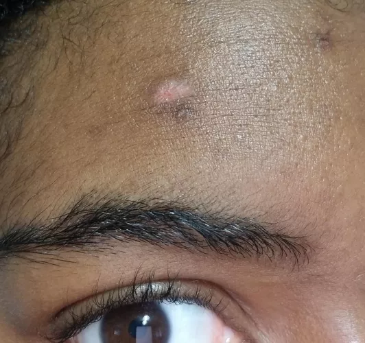 A PSA for all yall over pickers out there.... Was a whole lot worse Wednesday by green-cheeseburger