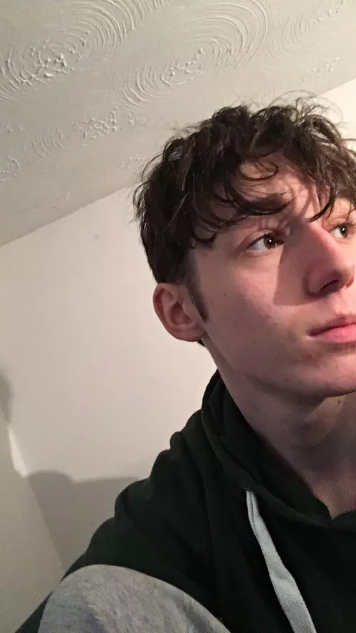 A rare picture of myself where I don’t dislike everything about it, even though I’m breaking out a lil by Substantial-Feed8237