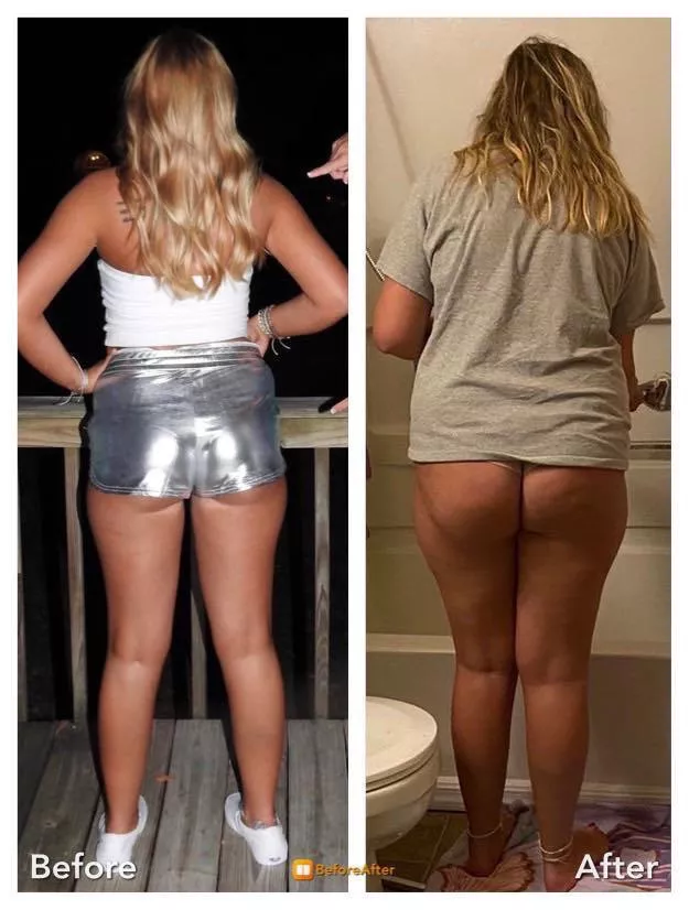 A year later and lots of cellulite to show posted by keaton932