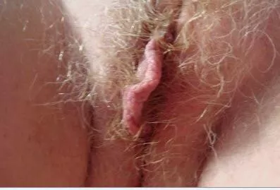 About a red cunt hair posted by Cecilserpent