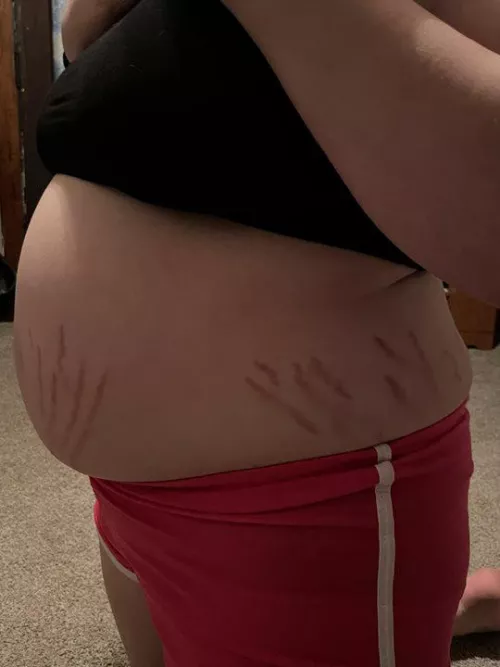 About to burst! 💥💥 by Gritty54