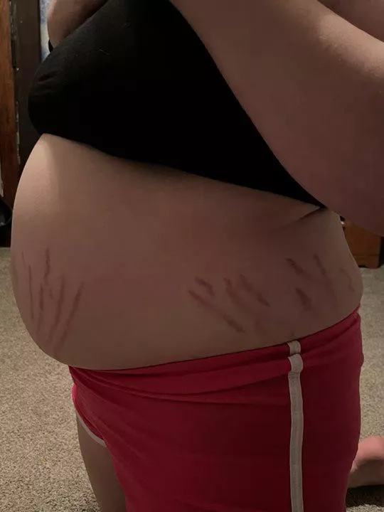 About to burst! 💥💥 posted by Gritty54