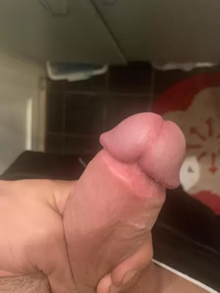 Adult circ 6 months ago, self consious about the scar, would u guys/girls be bothered by it? by Dry-Contribution-664