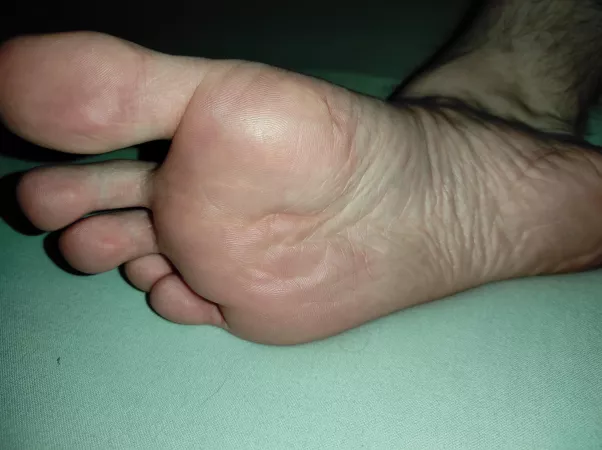 After a long day of wearing shoes, they're finally free by TheMoonSwimmer