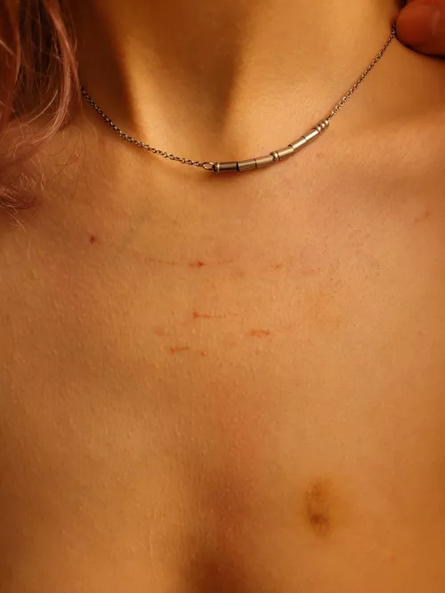 After a very rough play session with Sir, my collar left marks on my skin without either of us knowing until after, what a lovely surprise 🤤 by previouslyaghost