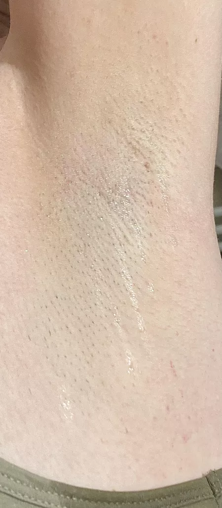 After a walk in the sun this is how I came home 🙊 by sunnypits