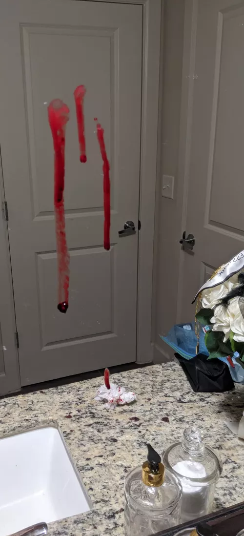 After math of a hematoma by my ear. by Spiridione