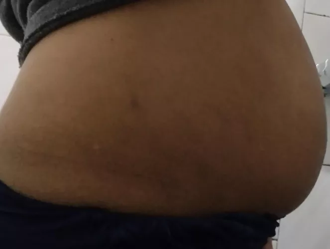 after my pregnancy I ended up with a belly like this by akane_testarossa