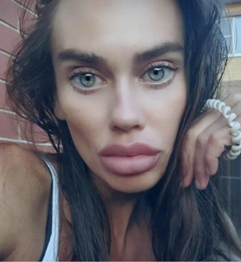 Albi posted by Money666666