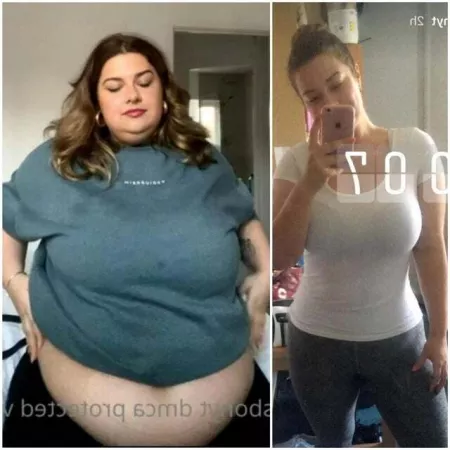 Aliss Bonython's weight gain before and after by Googlebin