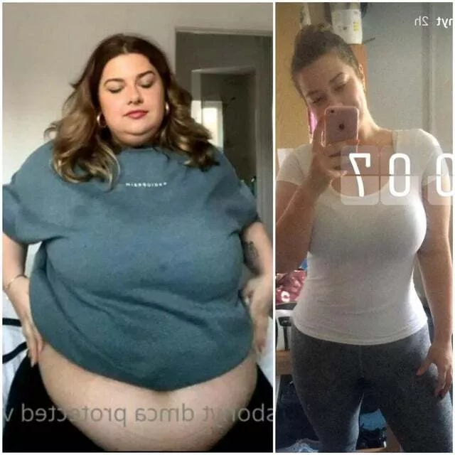 Aliss Bonython's weight gain before and after posted by Googlebin