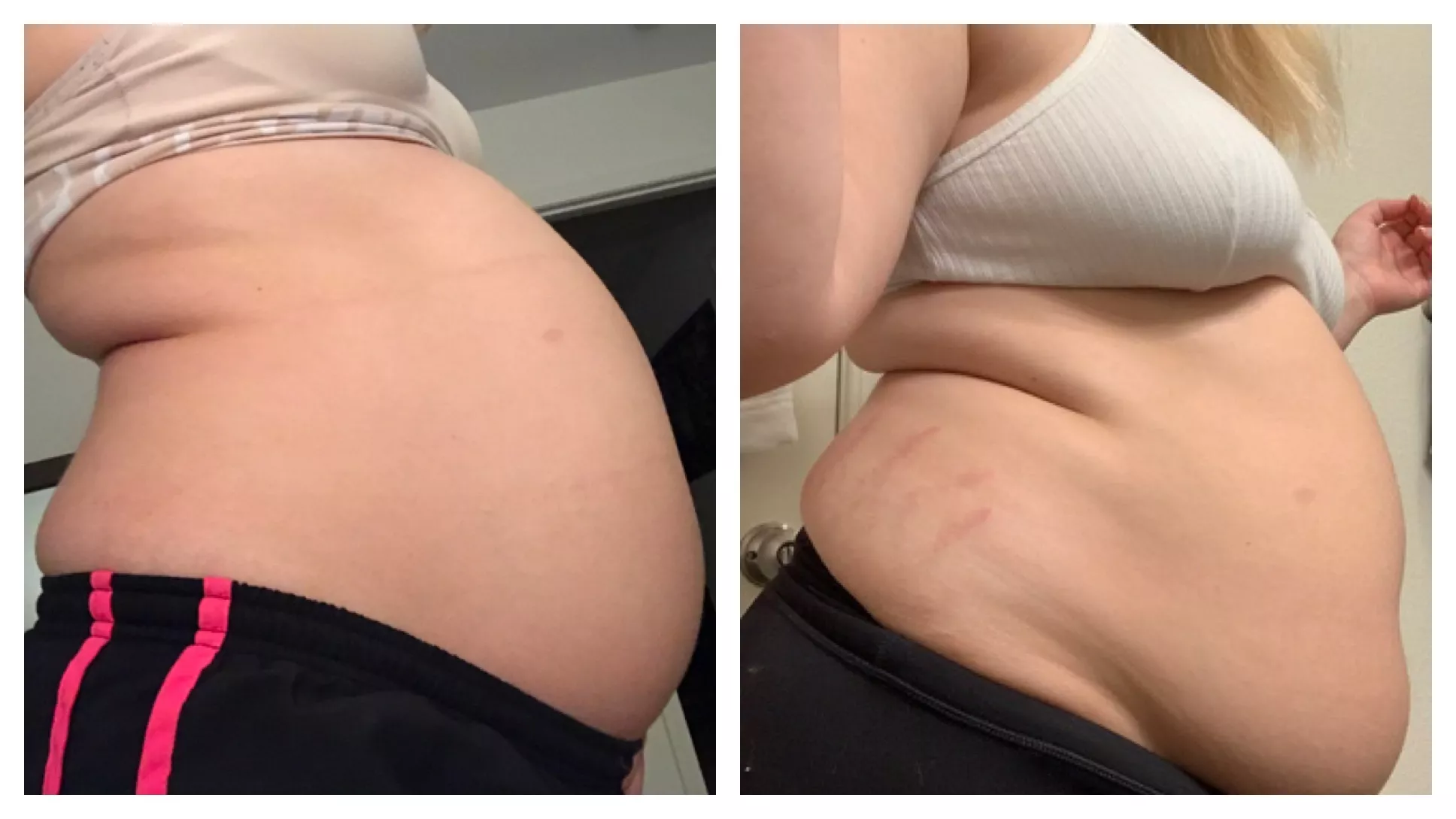 All That Food Had to Go Somewhere 👀 posted by Spotty_0093