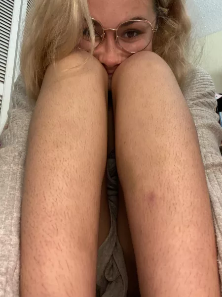 Always hairy and bruised 🤪 by Chance_Landscape_203