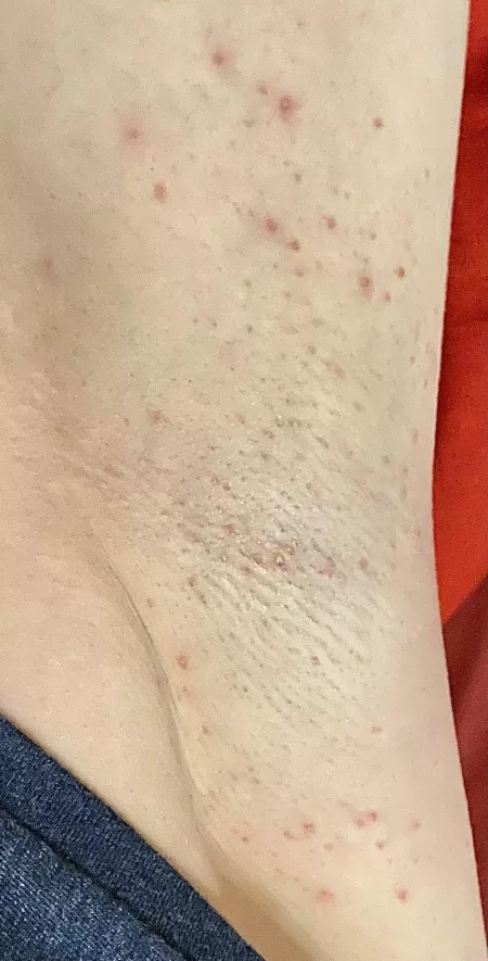 And now just shaved for the beach 🤗 I hope someone will notice them by sunnypits