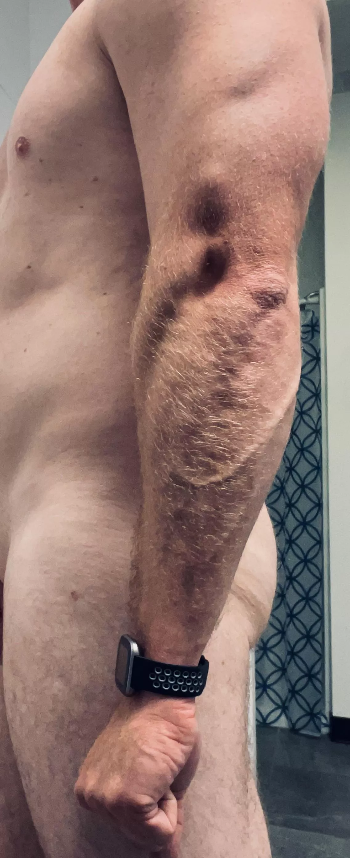 And today is a rest day😏 posted by Incoganonymous99