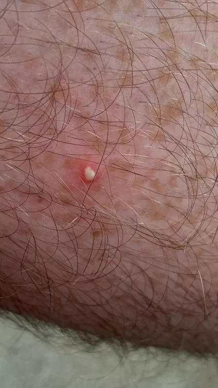 Angry wee boy on my leg this morning by FistedPink