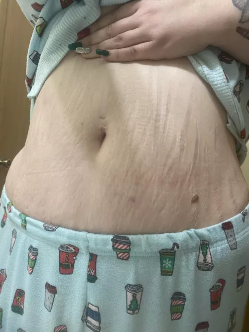 Any love for stretch mark speckled mommy bellies? by Pinkaliencome