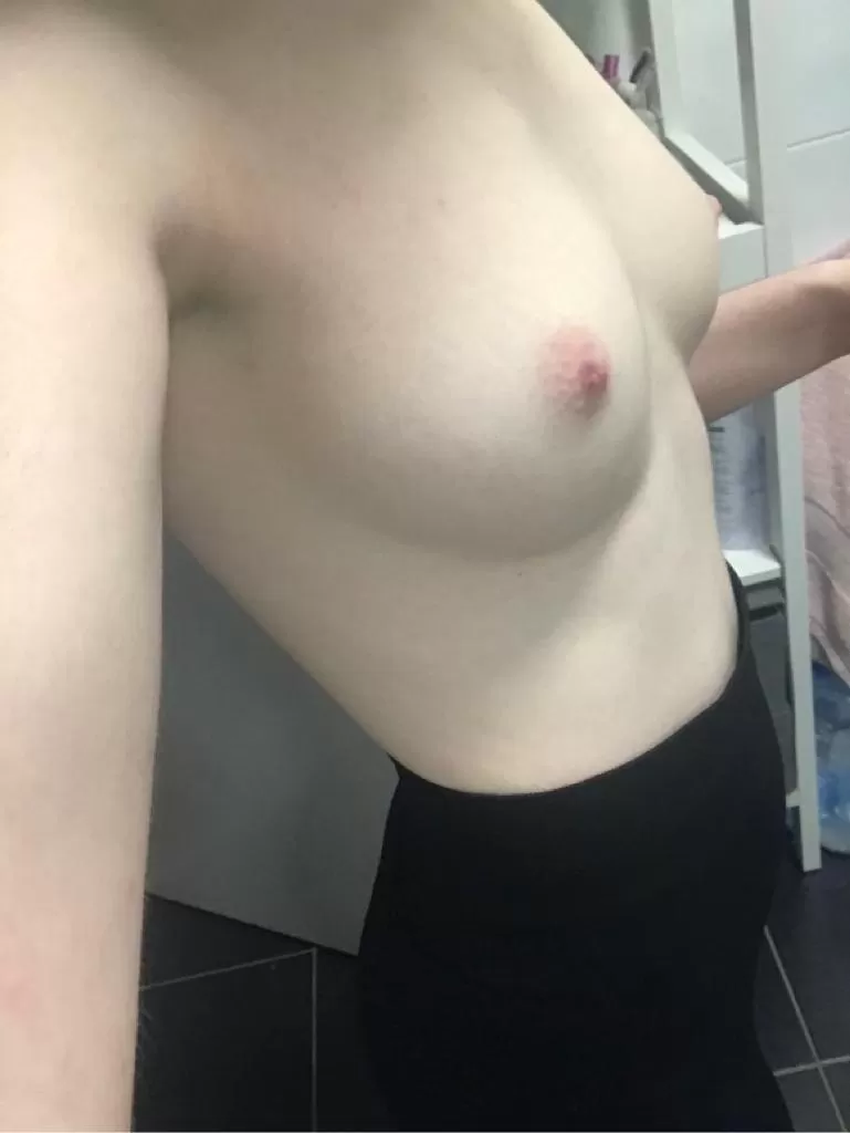 Any pale itty-bitty-titty love here??? 🥰 (F) posted by roseoftheoasis