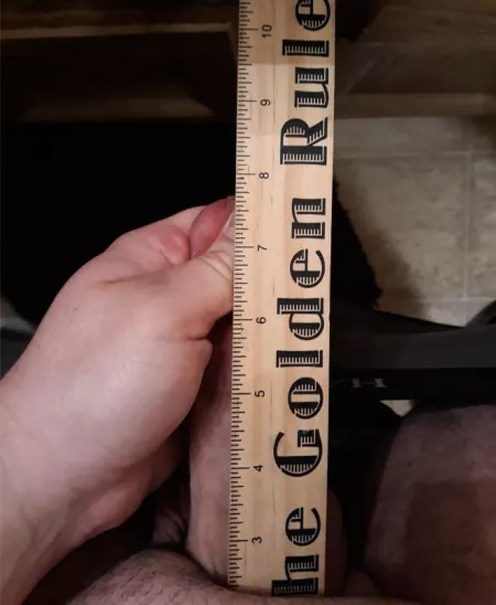 Anyone Else have a huge fatpad like this? by INMF88