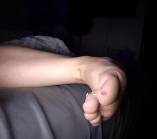 Anyone here good at kissing boo boos?😢 by Lilsmokahontus