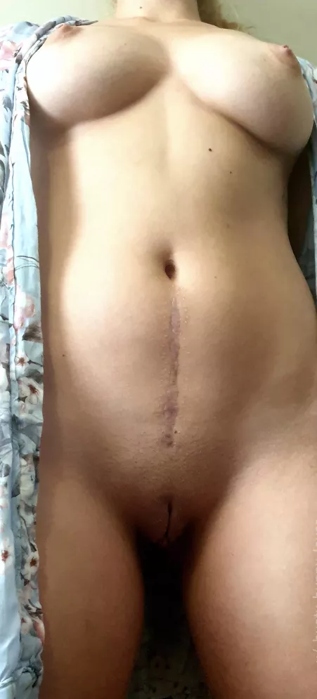 Are girls with scars welcome here? by HateAllYouWant