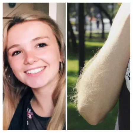 Are my arms hairy for a girl?? 😕 by Live_Finger_9607