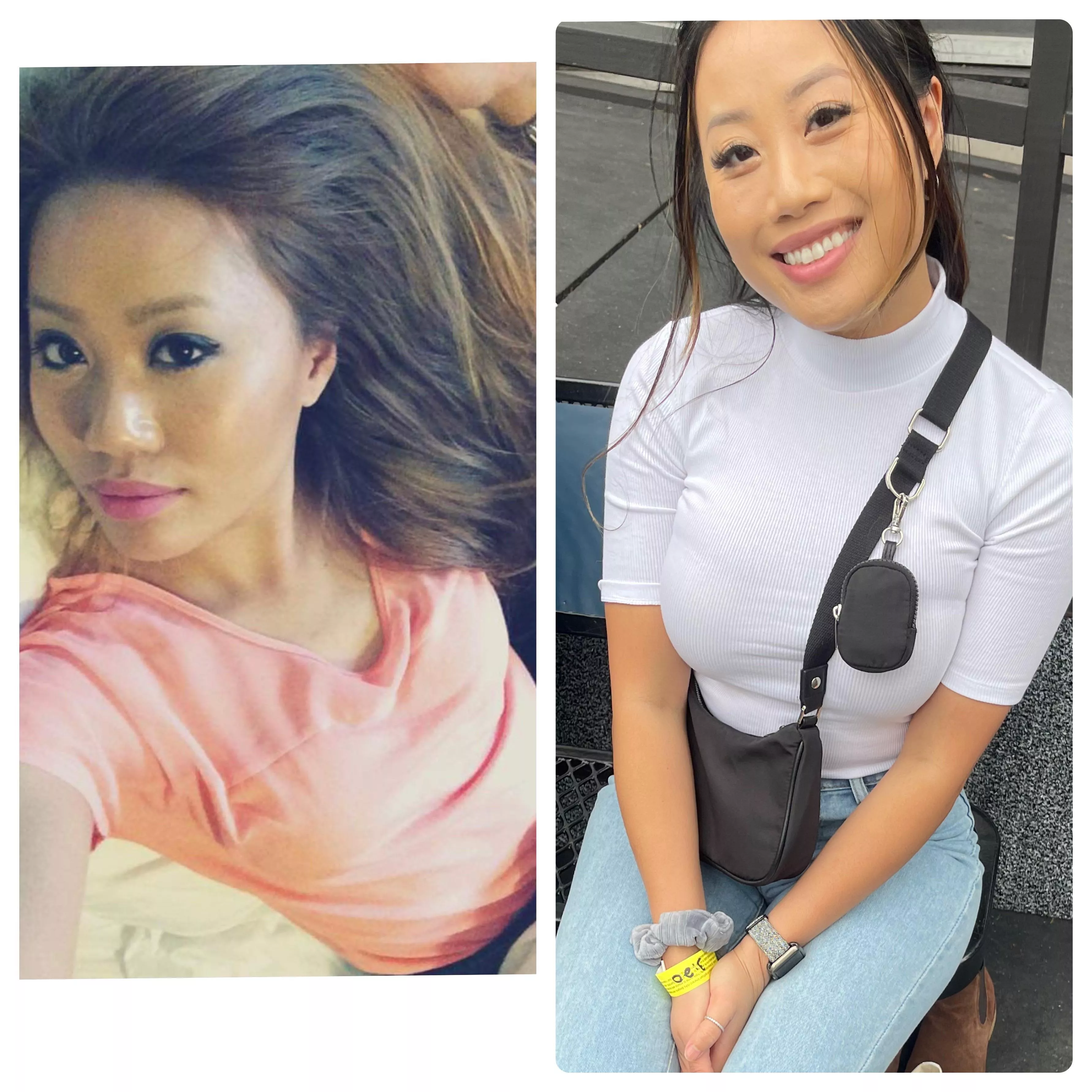 Asian breast growth 32A to 32F posted by LampGiraffe1