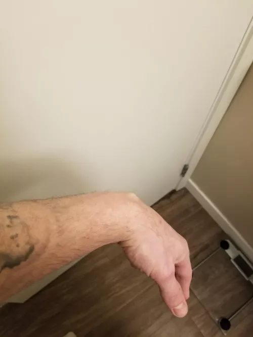 Baby ganglion. Havent decided if I want to smack him with a book or not yet. by Captain-Stubing