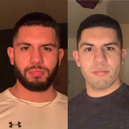 Beard or no beard by thirtylookingmf