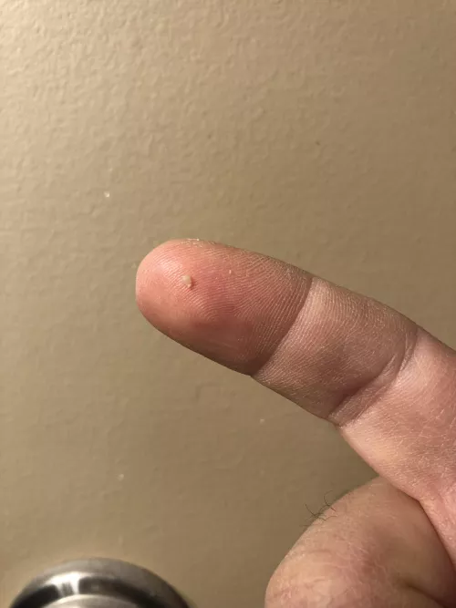 Been inside my nostril for weeks. I couldn’t take it anymore. Practically had to turn my nose inside out to get it. by Bentrail