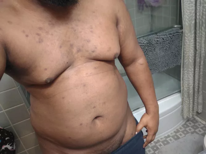 Been working out again. Showly getting my abs back by noahofconcern