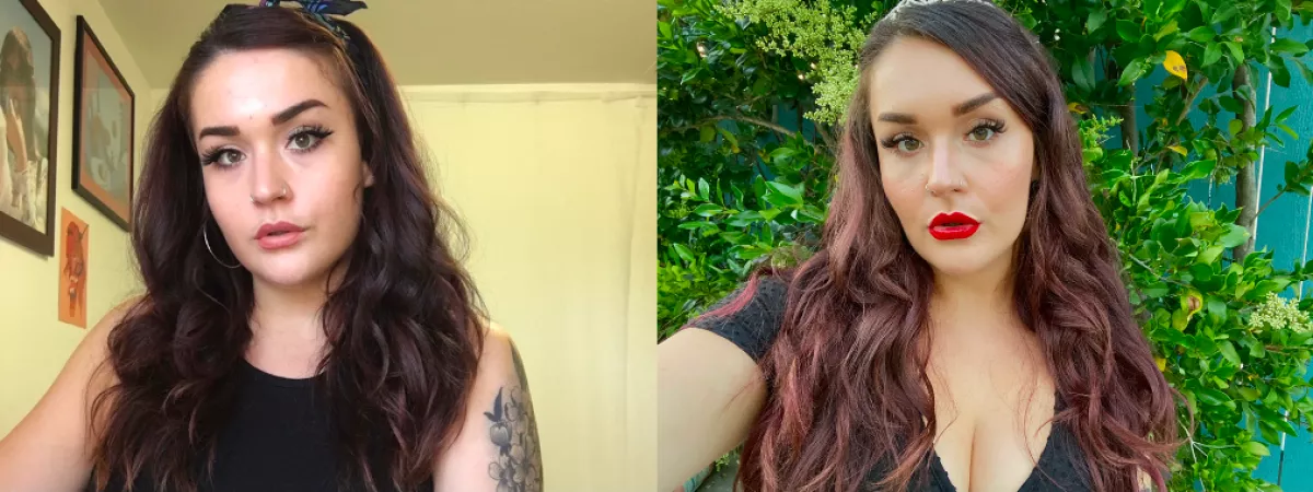 Before & after 40 units of Botox in my jaw 🤩 1st round of lip filler to come in the next month or so! by these-lil-piggies