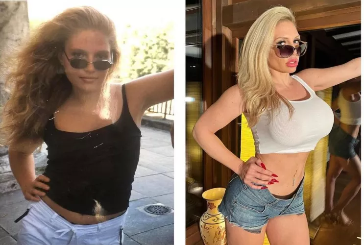 Before / After by testingoutmynewaccou