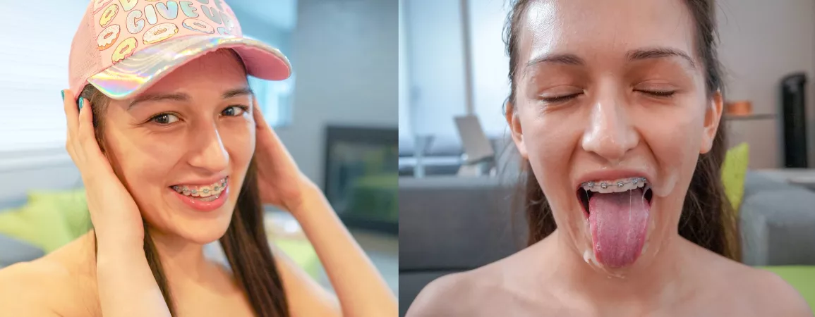 Before and a[f]ter cumshot on braces [OC] vid in comments by I_luv_pron