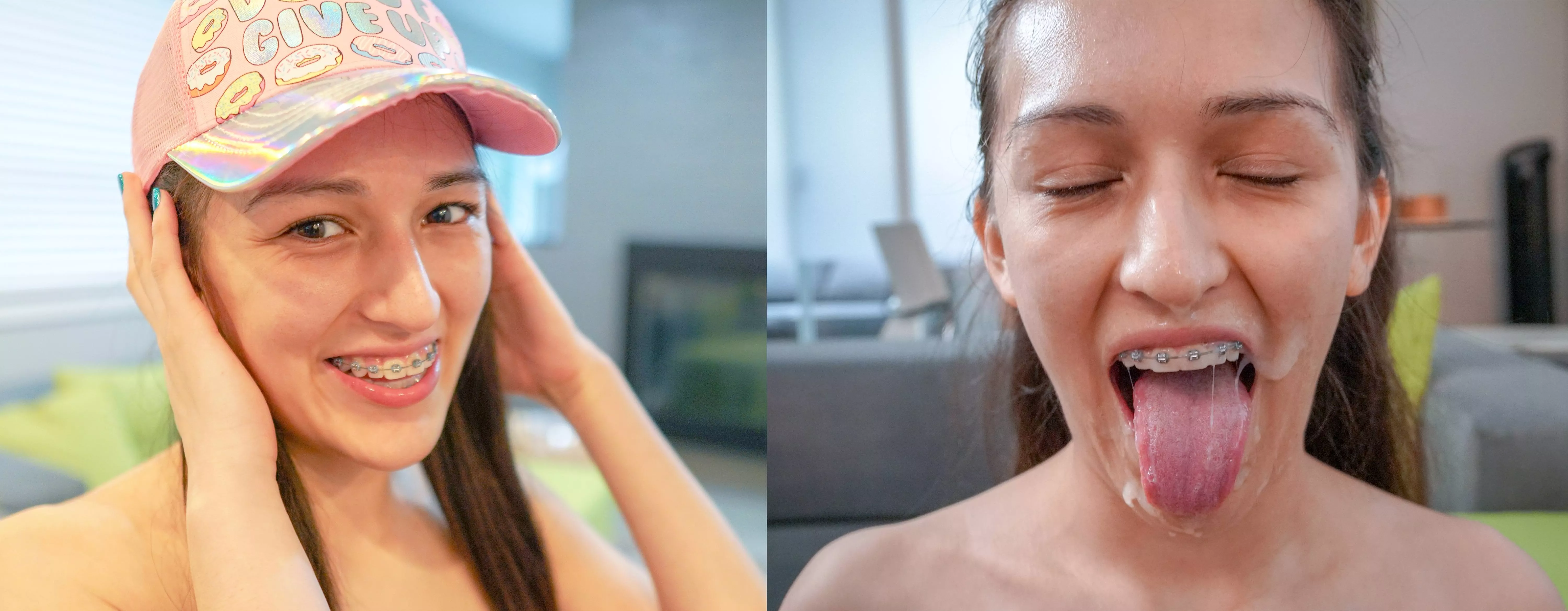 Before and a[f]ter cumshot on braces [OC] vid in comments posted by I_luv_pron