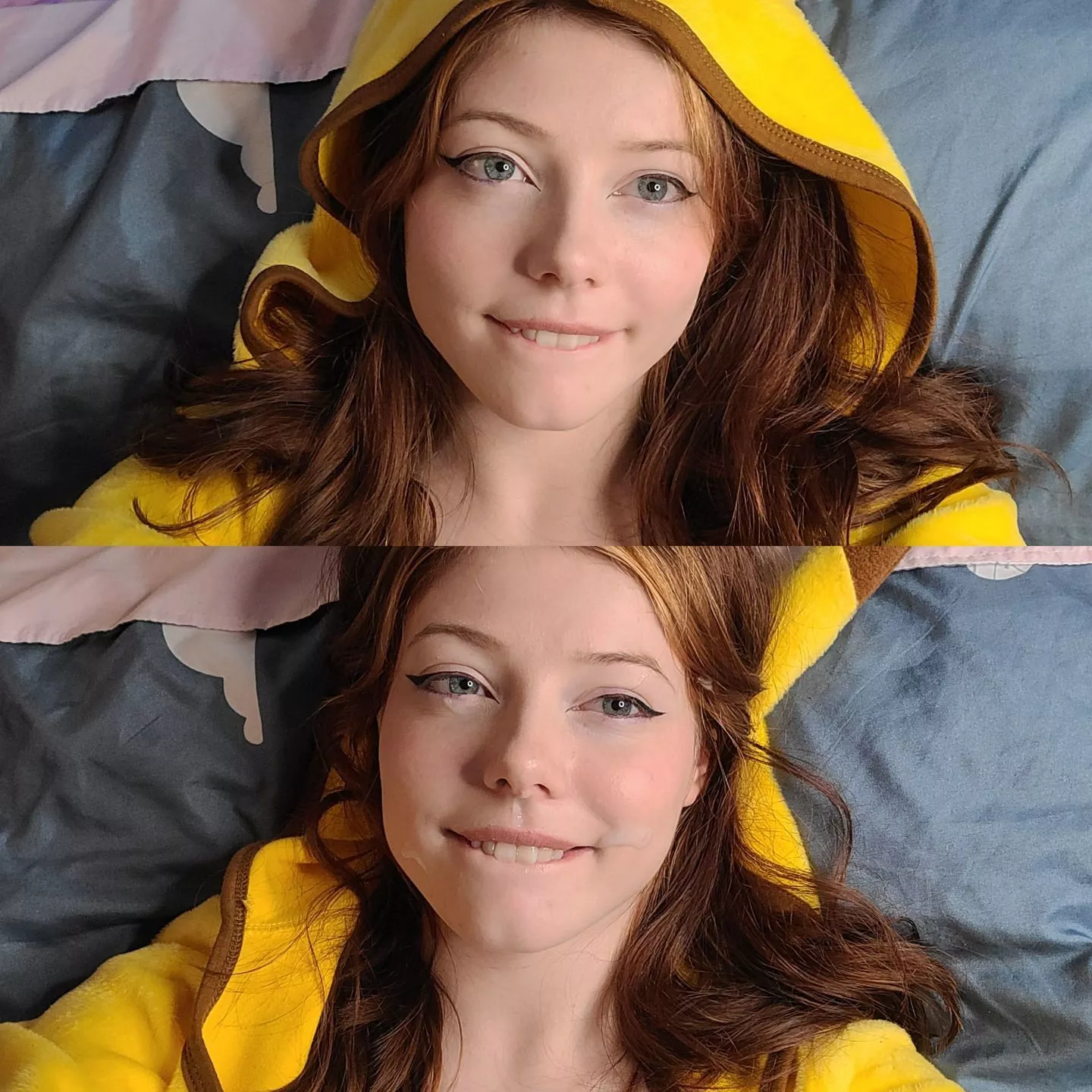 Before and after facial posted by Rylie_Rowan