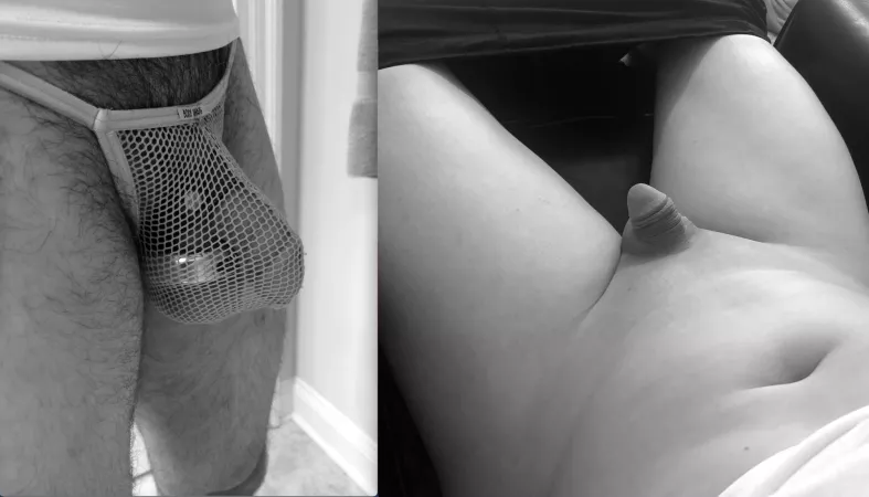 Before and after permanent hair removal. I wouldn't have it any other way by sds8201