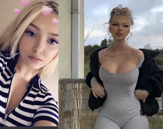 Before and after , the lip fillers really made me 100 times hotter by Initial_Connection85