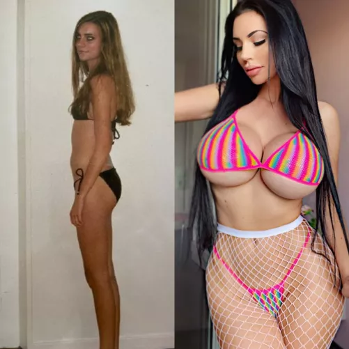 Before nad atfer done right  (yvonne bar) by stipulateburberry