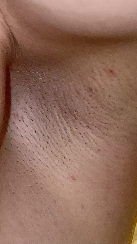 Before shaving 🪒😛 by sunnypits