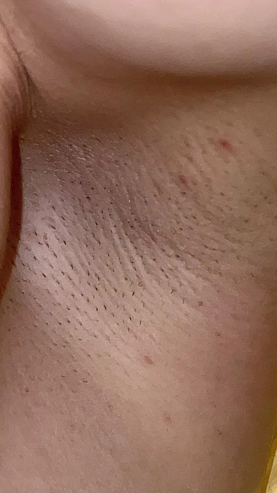 Before shaving 🪒😛 posted by sunnypits