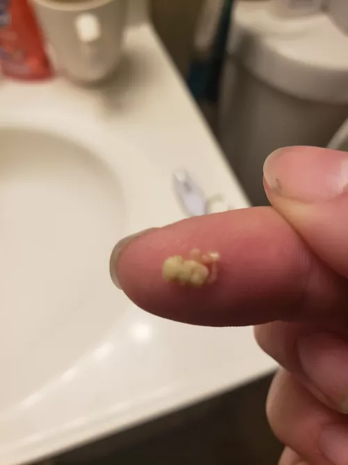 Before this sub I didn't even know tonsil stones were a thing..today, I pulled this out. by l4rest15