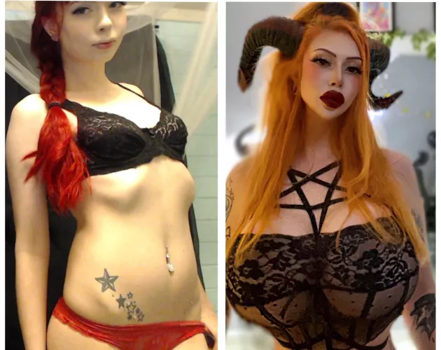 Before vs After - 750cc implants, lip and chin fillers, BBL by Sadbunnypeachy