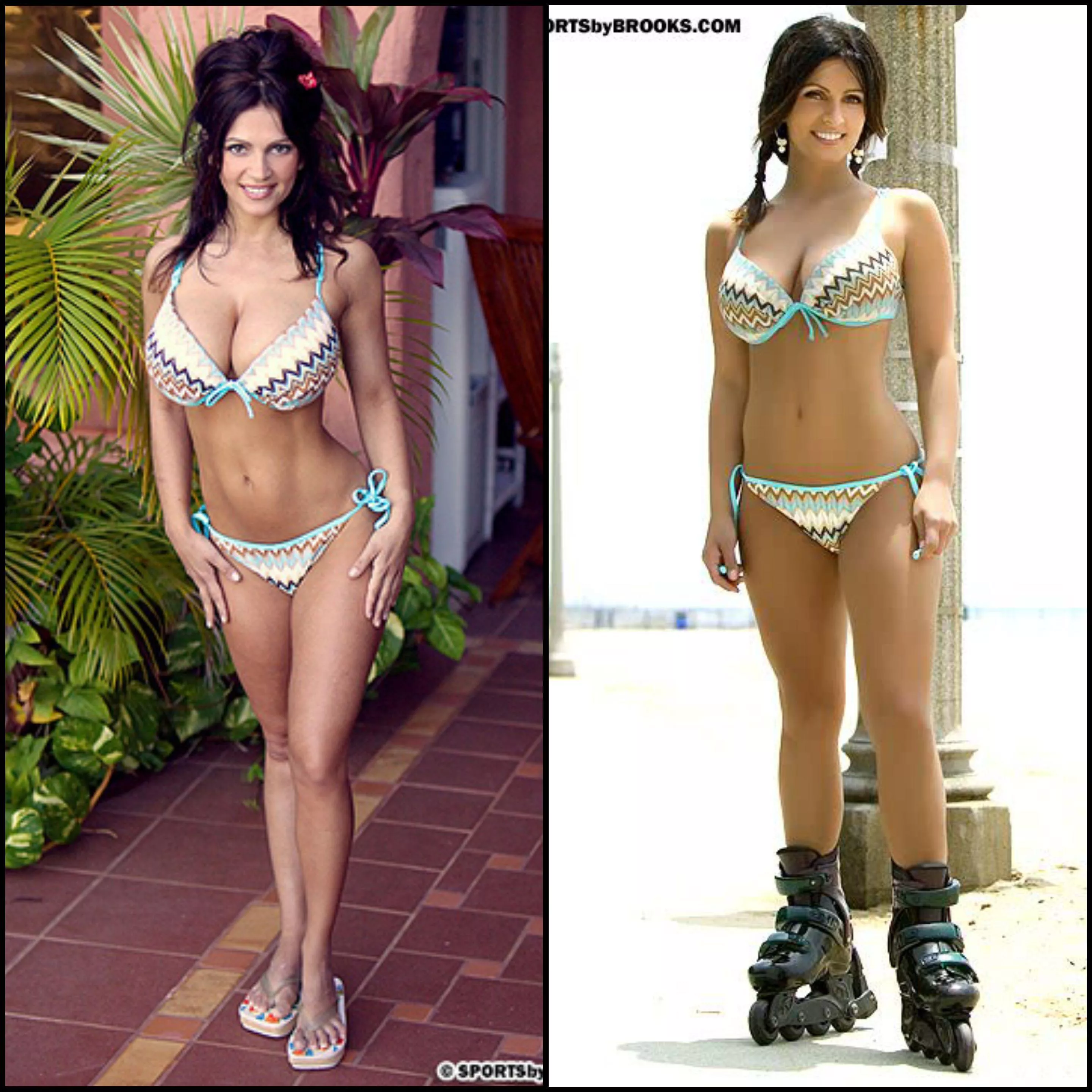 Before/After Surgery posted by TheSicConnection