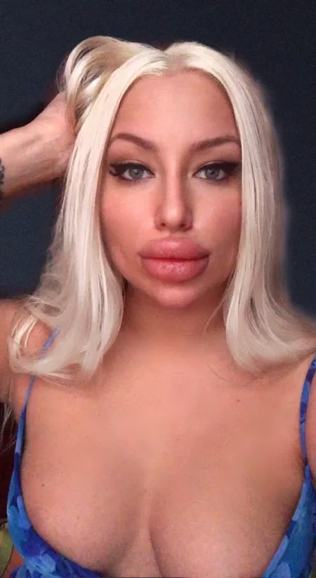 Big Fake Lips by gosterime