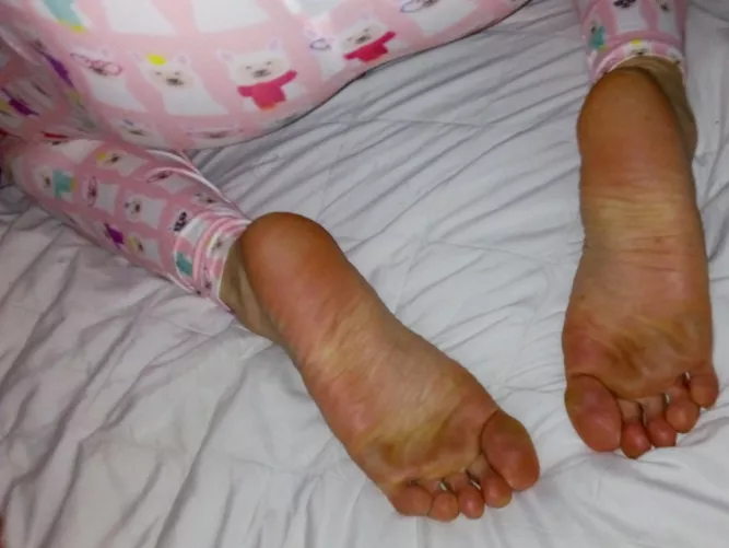 Big Feets 😄💅👣❤️ by StrafeKing1991